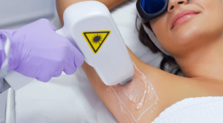 Laser Hair Removal