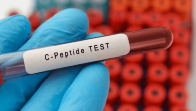 test for C-peptide