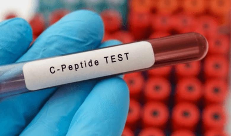 test for C-peptide