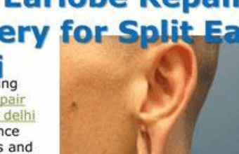 earlobe repair cost