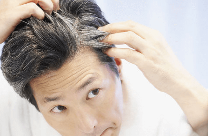 CAUSES OF WHITE HAIR
